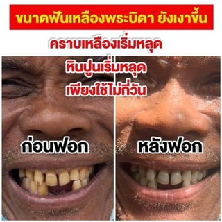 ส่งฟรี 1แถม1 Dental Switz(เดนทัล สวิตซ์) เจลฟอกฟันขาว ฟันเหลือง คราบชา กาแฟ คราบบุหรี่ ลดกลิ่นปาก ลดคราบหินปูน