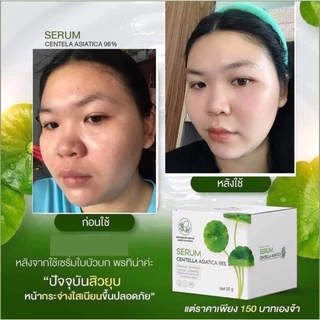 เซรั่มใบบัวบกพรทิน่า Pontina Serum Centella 30กรัม