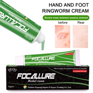 FOCALLURE Body Psoriasis Cream Dermatitis Eczematoid Eczema Ointment Treatment Psoriasis Balm 15g