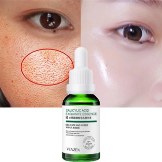 Veze Salicylic Acid Pore Minimizer Serum เซรั่มบํารุงผิว ให้ความชุ่มชื้น กระชับรูขุมขน 30 มล.