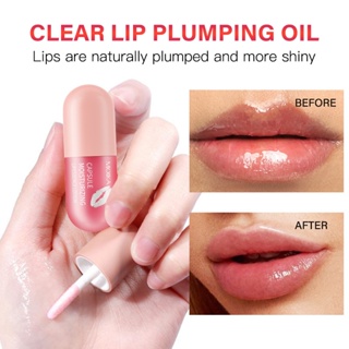 Lip Plumper MOIKA ลิปเอสเซ้น โลชั่น น้ํามันธรรมชาติบริสุทธิ์ ให้ความชุ่มชื้น ซ่อมแซมริมฝีปาก