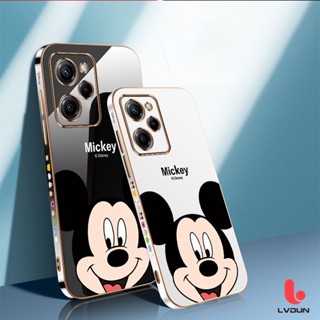 เคส Poco X5 Pro 5G Poco X5 5G Poco X3 GT 5G Poco X3 Pro X3 NFC Poco X3 Poco X4 Pro 5G Poco X4 GT 5G Mickey Soft Case 2B-MQ