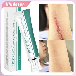 Breylee Acne Scar Removal Cream ครีมบำรุงผิวหน้า Repair Skin Care รอยแผลเป็นสิวลบเครื่องหมายยืด HO