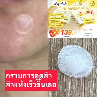 CHER Acne Clear Spot Patch เฌอ แผ่นดูดซับสิว