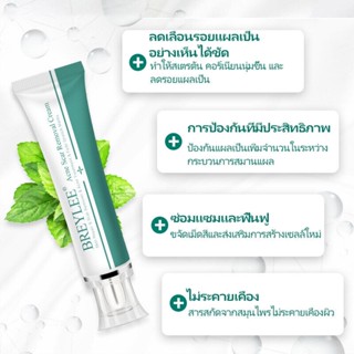 【 BREYLEE】ครีมลดรอยแผลเป็น ครีมลบรอยแผลเป็นจากสิว ยาลดสิว ครีมทาแผลเป็น ขนาด รอยสิว สำหรับรอยสิว ครีมรักษาแผลเป็น ครีมรั