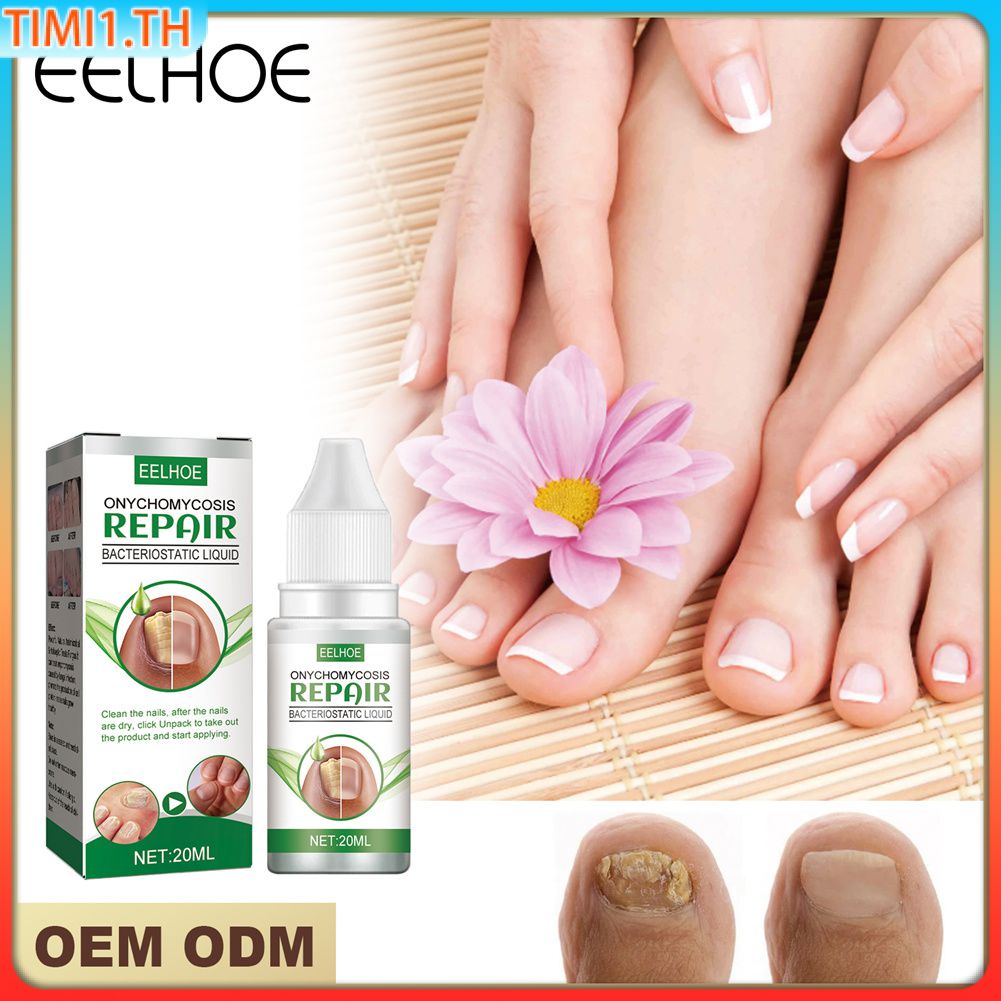 Eelhoe Repair Nail Fungus Treatments Essence Foot Care Serum Toe Nail Gel Removal Fungal Anti-Infection Onychomycosis | Timi1