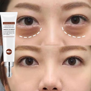 Eyebag Remover อายครีม ลดรอยคล้ําใต้ตา 20 กรัม ปลอบประโลม และบํารุงผิว เพื่อปรับปรุงผิว