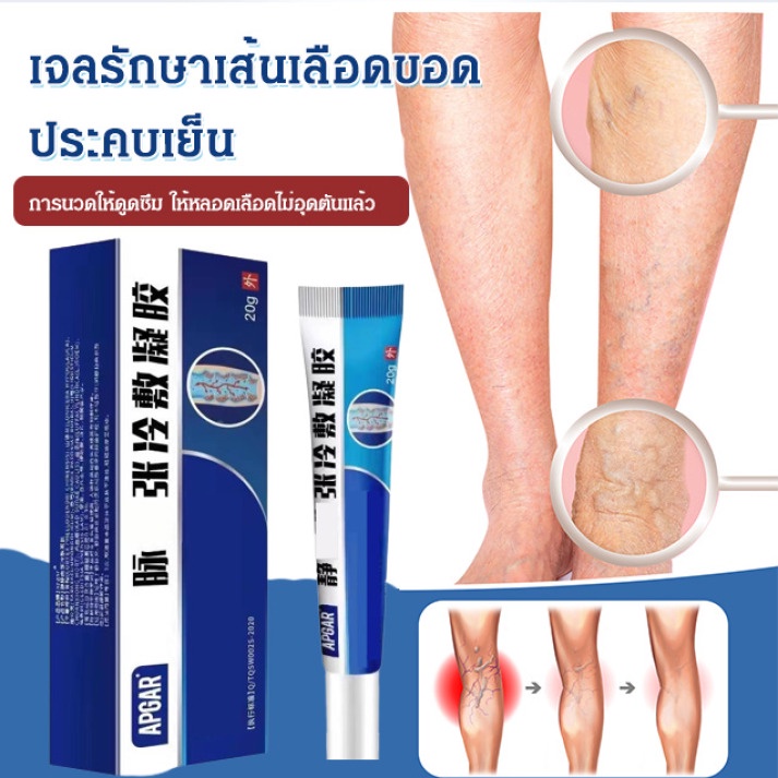 [ซื้อ 1 ฟรี 1] เจลรักษาเส้นเลือดขอดประคบเย็น 20g