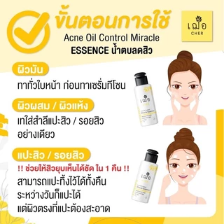 CHER Acne Oil Control Miracle Essence Oil Free เฌอ น้ำตบลดสิว 100 g