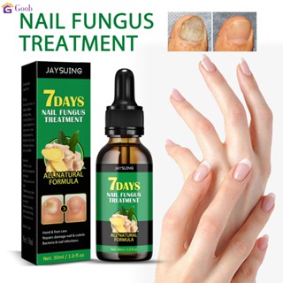 Jaysuing Ginger Nail Care Solution 30Ml Nail Fungus Repair Hand, Foot Nail Care Soft Nail Bright Nail Moisturizer 【Goob】