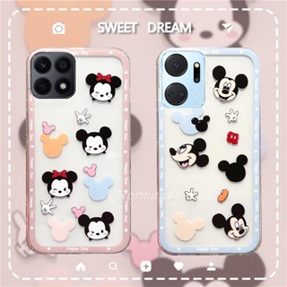 ใหม่ เคสป้องกันโทรศัพท์มือถือใส แบบนิ่ม ลายการ์ตูนมิกกี้ มินนี่ เมาส์ สําหรับ Honor X7a X8a X9a X5 5G 4G 2023