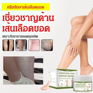 ครีมรักษาเส้นเลือดขอด ยาทาบรรเทาปวด 50g