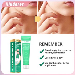 2023ใหม่ผิวหูดจุดและ Nenus Remover ครีมเจ็บปวดหูด Remover เซรั่มกระจุดด่างดำใบหน้าหูดรักษากำจัดน้ำมันหอมระเหยโฮ
