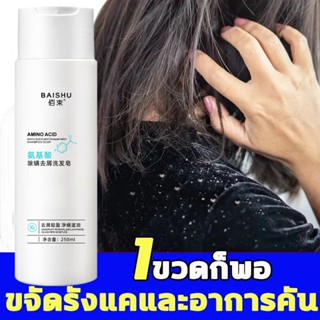 แชมพูแก้รังแค 250ml แชมพูสระผมแก้เชื้อรา ยาสระผมแก้เชื้อรา ยาสระผมเชื้อรา ขจัดรังแค เชื้อราบนศีรษะ ครีมสระผม