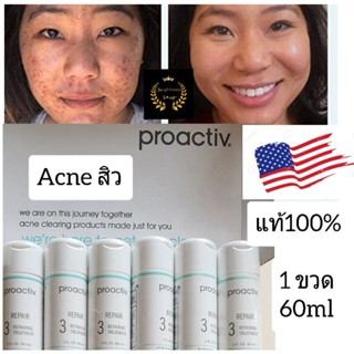 Proactive solution repairing treatment Proactiv โปรแอคทีฟ ครีมทาสิว ของแท้!!! อเมริกา การันตี ครีมแต้มสิว ครีมลดสิว สิว