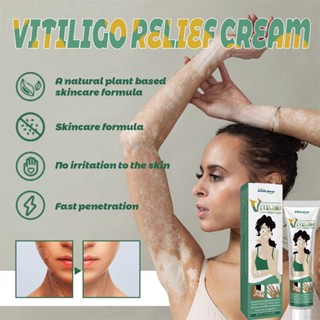 ♕South Moon Vitiligo Relief Ointment Repair White Spot Clean Ointment Moisturizing Fading Body Skin Marks Body Care 20G Wfuture♕