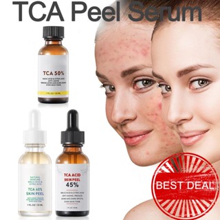 Tca เอสเซ้นบํารุงผิว ฟื้นฟูผิว เอสเซ้นส์กําจัดสิว ซ่อมแซมสิว H3W5