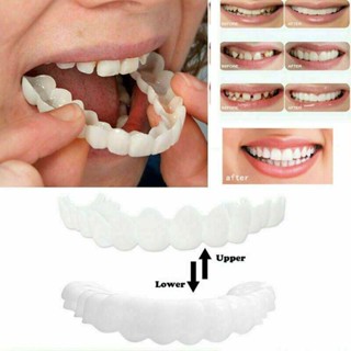 Smile Snap On False Teeth Upper &amp; Lower Dental Veneers Dentures Tooth Cover Set