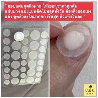 CHER Acne Clear Spot Patch เฌอ แผ่นดูดซับสิว