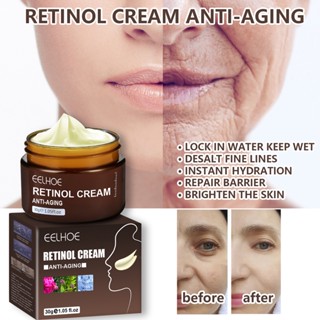 Retinol ครีมบํารุงผิวหน้า ต่อต้านริ้วรอย ให้ความชุ่มชื้น 30 กรัม