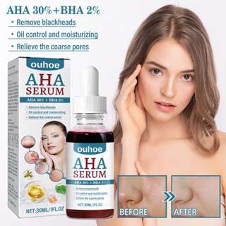 Ouhoe AHA เซรั่ม 30 มล. AHA30%+BHA2% AHA BHA เซรั่ม BHA หัวหลัง พาวเวอร์ ลิควิด กําจัดสิวหัวดํา