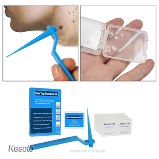 อุปกรณ์กำจัดหูด ไฝ ติ่งเนื้อ หลุดออกอย่างง่ายดาย Medical Skin Tag Kill Remover