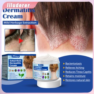 Seborrheic Skin Cream Skin Cream Scalp Ringworm Head Acne Itching Skin Problem Repair HO