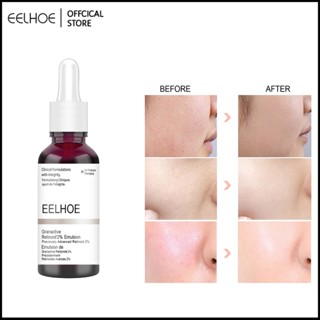 EELHOE Anti Acne Exfoliating Face Serum Peeling Solution Pore Shrinking Serum Oil-Control Firming Moisturizing Repairing Smoot-Eelhoe