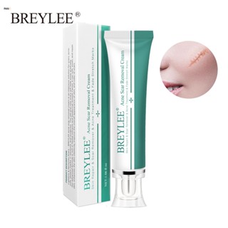 BREYLEE Scar Removal Gel 30g ครีมลดรอยแผลเป็น ลดผิวแตกลาย ลบรอยแผลเป็น ลดเลือนป้องกันรอยแผลเป็น nuuo