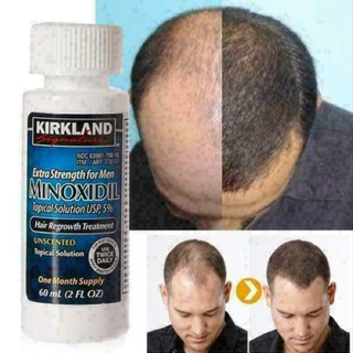  Kirkland Hair Growth Liquid 60ML is rich in minoxidil, which is mild, effective, and non irritating