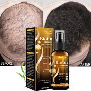 Biotin ผลิตภัณฑ์ปลูกผม น้ํามันหอมระเหย ป้องกันผมร่วง รักษาหนังศีรษะ สําหรับผู้ชาย และผู้หญิง