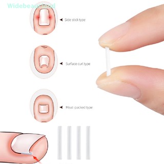 Widebeaucloud 10 ชิ้น คลิปยืดเล็บเท้า เล็บคุด แก้ไขเล็บคุด สติกเกอร์ แก้ไขเล็บได้ดี