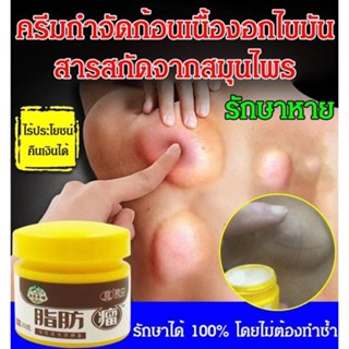 JS-Lipoma Buster (7 วันเพื่อกำจัด lipoma)