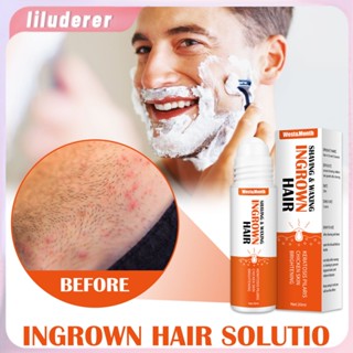 West &amp; Month Ingrown Hair Serum Essence ป้องกันผมจากการเจริญเติบโตภายในหดตัวรูขุมขนคืนความเรียบเนียนของผิวและให้ความชุ่มชื่นแก่สาระสำคัญ HO