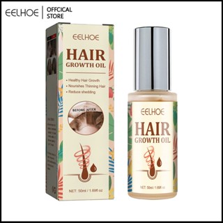 EELHOE Hair Biological Oil Nourish Hair,Anti-Broken Hair And Dryness,Dry Hair,Long Nursing Essential Oil-Eelhoe