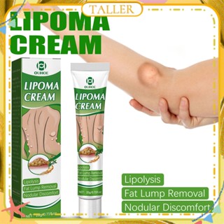 ✧ Ready Stcok Ouhoe Lipoma Removal Ointment สมุนไพรธรรมชาติขุดลอกไขมันในร่างกาย Knot Cumps มวลใต้ผิวหนังไม่ระคายเคือง Body Care สูง20G