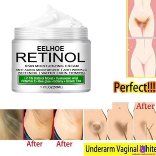 Eelhoe Retinol Cream Whitening To Remove Melanin Brightening Cream Fairy Skin Original For Private Parts/body/underarm/neck Aubestechstore