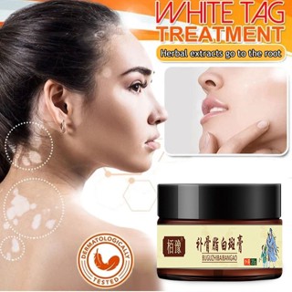 Vitiligo ครีมบํารุงผิวหน้า ไวท์เทรทเม้นท์ ไวท์เทรทเม้นท์ ออร์แกนิก