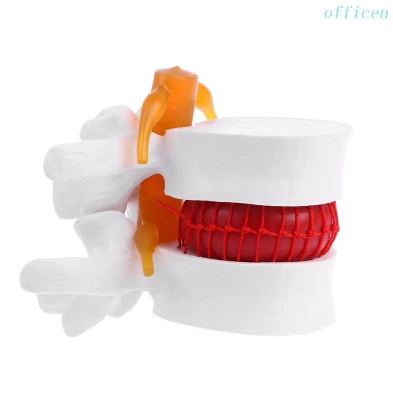 กายวิภาคของมนุษย์ Lumbar Disc Herniation Model การแพทย์ เรียนรู้ Aid Anatomy Instrume