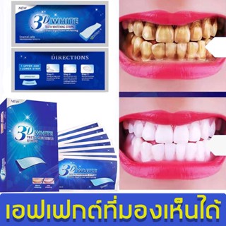 ฟันยิ่งสกปรก ยิ่งใด้ผลด 3DWHITE แผ่นฟอกฟันขาว 7 คู่ แก้ฟันเหลือง คราบจุลินทรีย์ คราบกาแฟ แผ่นแปะฟันขาว ยาฟอกฟันขาวแท้