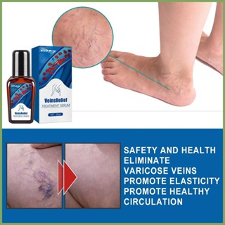 Veins Relief Treatment Serums Veins Repair Liquid Varicose Relief Veins Repair Liquid บรรเทาอาการเส้นเลือดดำ