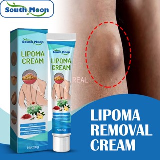 CYREAL ✧ South Moon สารสกัดจากพืชธรรมชาติ Lipoma Treatment Cream วัสดุจากพืชธรรมชาติไม่มีผลข้างเคียงบรรเทาอาการปวดกำจัด Lipoma 20G ส่วนผสมที่ปลอดภัย