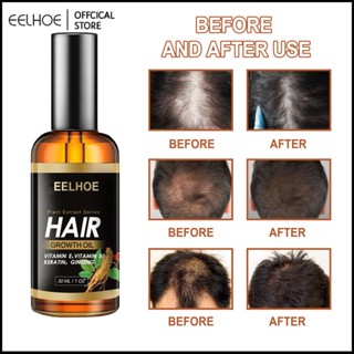 EELHOE 30Ml Hair Growth Serum Head Care เซรั่มปลูกผมโมร็อกโก-Eelhoe