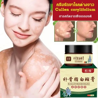 【1/2PCS】ครีมรักษาโรคด่างขาว Cullen corylifolium