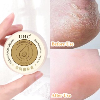 UHC Anti-Crack Cream Dry Cracked Heel Repair Exfoliating Dead Skin Foot Cracks 15g