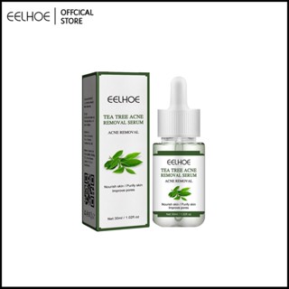 EELHOE Tea Tree Acne Repair Essence Lighten Acne Marks,Clean Acne,Acne Removing Acne And Repair Skin Essence-Eelhoe