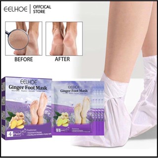 EELHOE Ginger Exfoliating Foot Mask Hydrating Moisturizing Anti-Cracked Moisturizing Skin Exfoliating Foot Care-Eelhoe