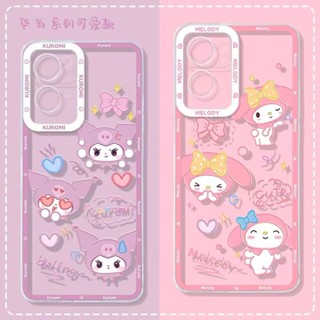 เคสโทรศัพท์มือถือ แบบนิ่ม ลายการ์ตูนเมโลดี้ สําหรับ case huawei Nova 11 7 9 10 SE Y61 Y70 Y90 3i 5T 7i 8i Y7A Y9S Y7 Y9 Prime 2019 P20 P30 Lite Mate 20 x Pro