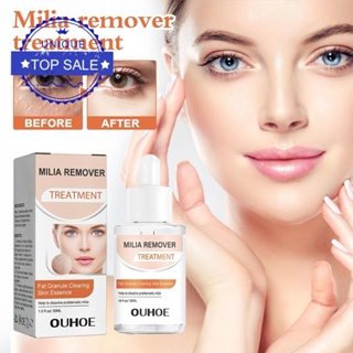 Milia Remover Essence เอสเซ้นบํารุงรอบดวงตา ต่อต้านริ้วรอย 30 มล. S0P6