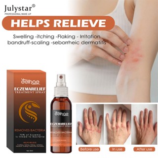 JULYSTAR Skin Relieving Spray Body Skin Care Care Leather Moss Red Swelling, Itching, Dry Repair Spray 30ml.